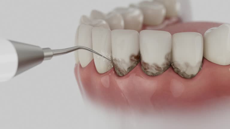 Trusted Emergency Dentist service in St. Martinville, LA - Dentist Open Now